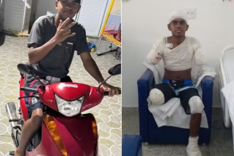 Adolescente tem membros amputados após descarga elétrica de 8 mil volts